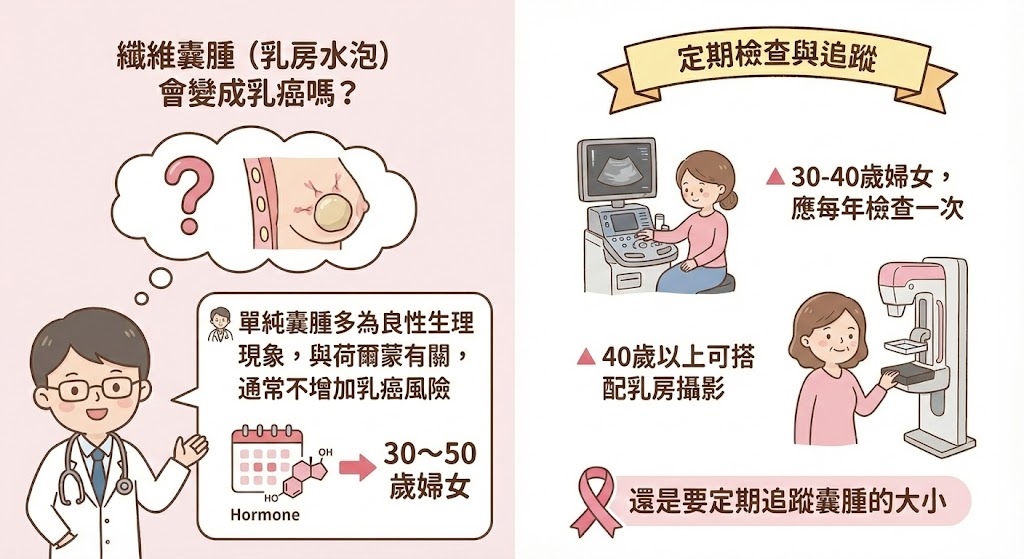 纖維囊腫會變成乳癌嗎？